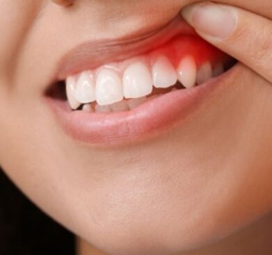 oral health teeth picture