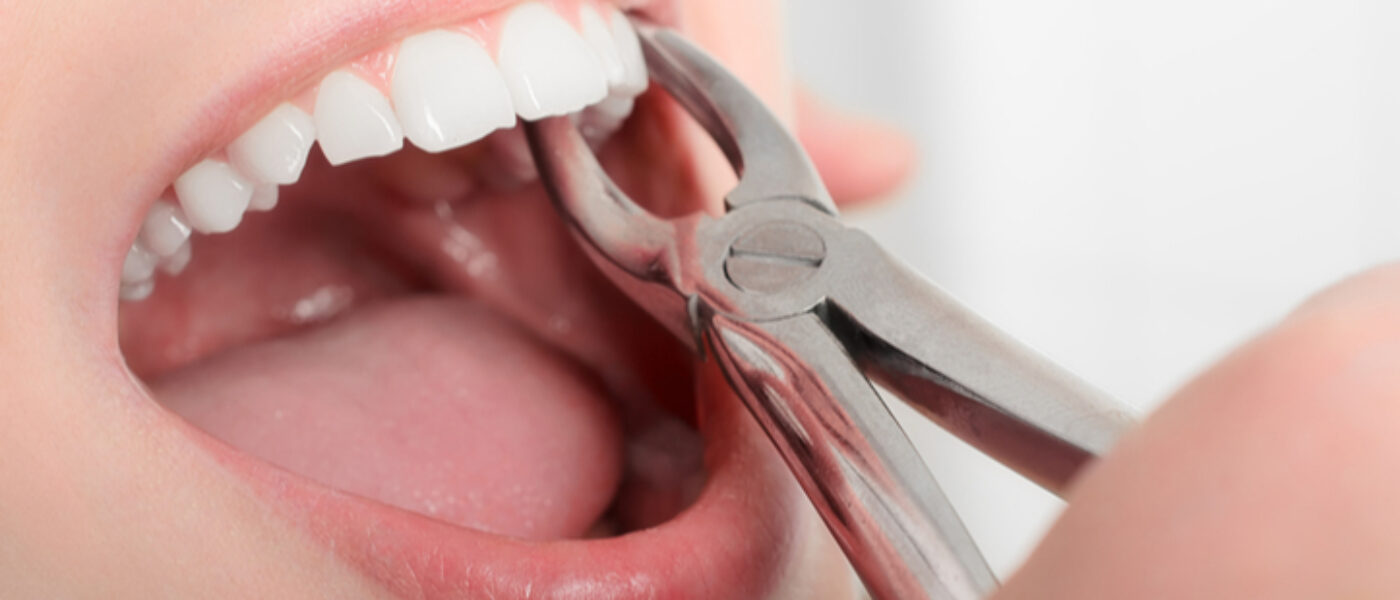 “I was forced to take matters into my own hands.” Exploring the dangers of DIY dentistry.